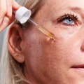Retinoids: The Anti-Aging Treatment Alternative