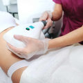 An Overview of CoolSculpting: Your Guide to Minimally Invasive Cosmetic Procedures