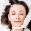 Understanding Migraines: All You Need to Know About Botox Injections for Treatment