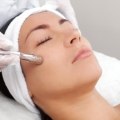 All About Microdermabrasion: A Guide to Safe and Effective Cosmetic Procedures