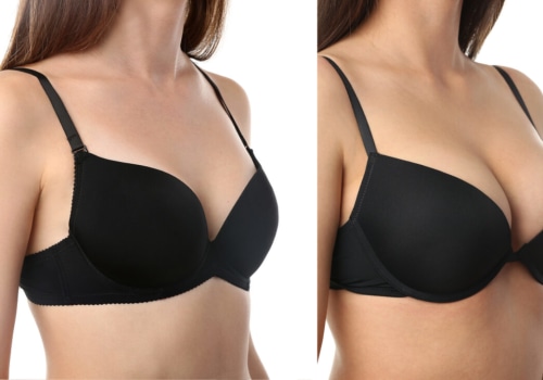 The Truth About Breast Augmentation