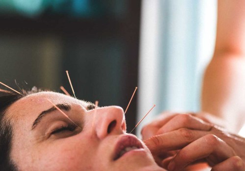 The Benefits of Acupuncture for Anti-Aging and Cosmetic Procedures
