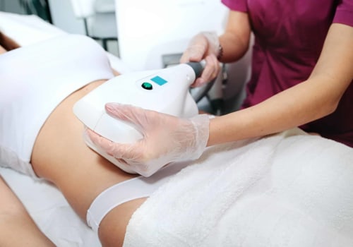 An Overview of CoolSculpting: Your Guide to Minimally Invasive Cosmetic Procedures